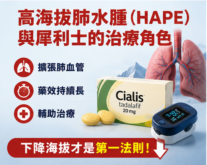 高海拔肺水腫（HAPE）與犀利士的治療角色